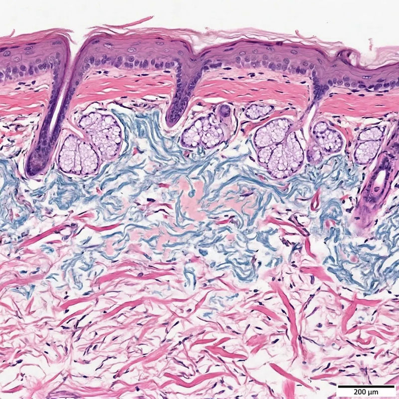 B: Photoaged, Wrinkled Female Facial Skin (H&E)