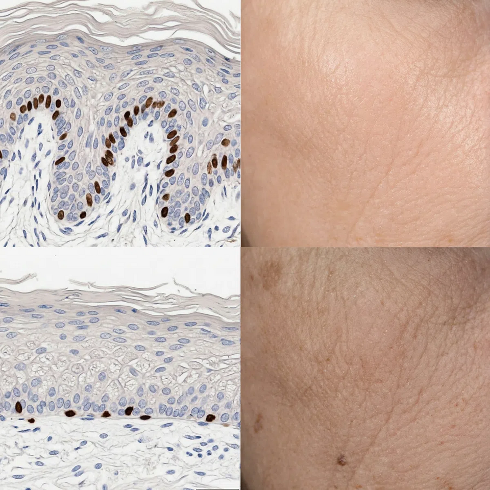 A simulation of Fontana-Masson stained histology of facial skin showing the skin structure of healthy skin and aged skin comparing cell turnover and the result to the surface.