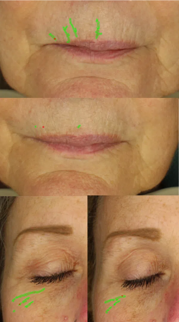 Surface level clinical trial results