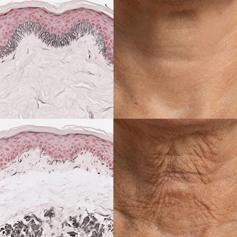A simulation of VVG stained histology of facial skin showing the skin structure of healthy skin and aged skin.