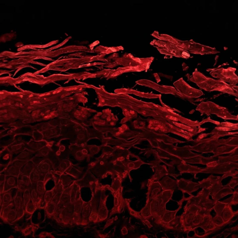 B: Photoaged, Wrinkled Female Facial Skin (H&E)
