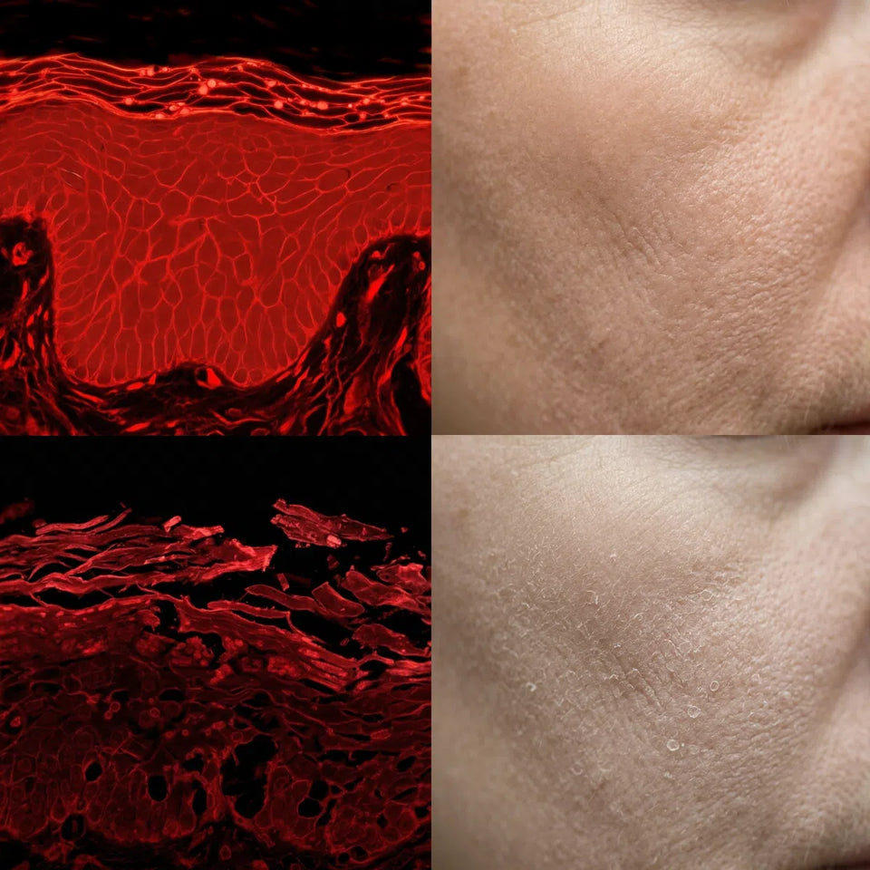 A simulation of Oil Red O stained histology of facial skin showing the skin structure of healthy skin and aged skin with a dry compromised skin barrier.