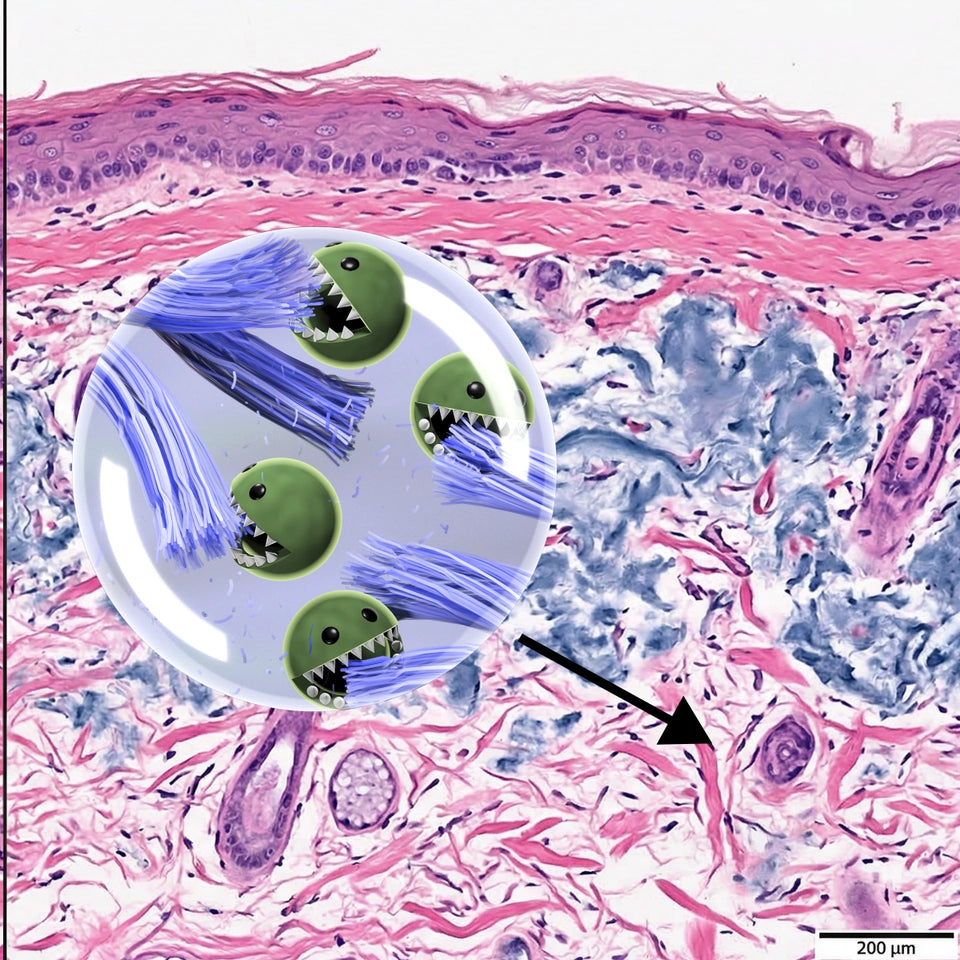 Simulation of H&E histology staining of aged skin. MMP-1 enzymes act like pacman eating collagen.