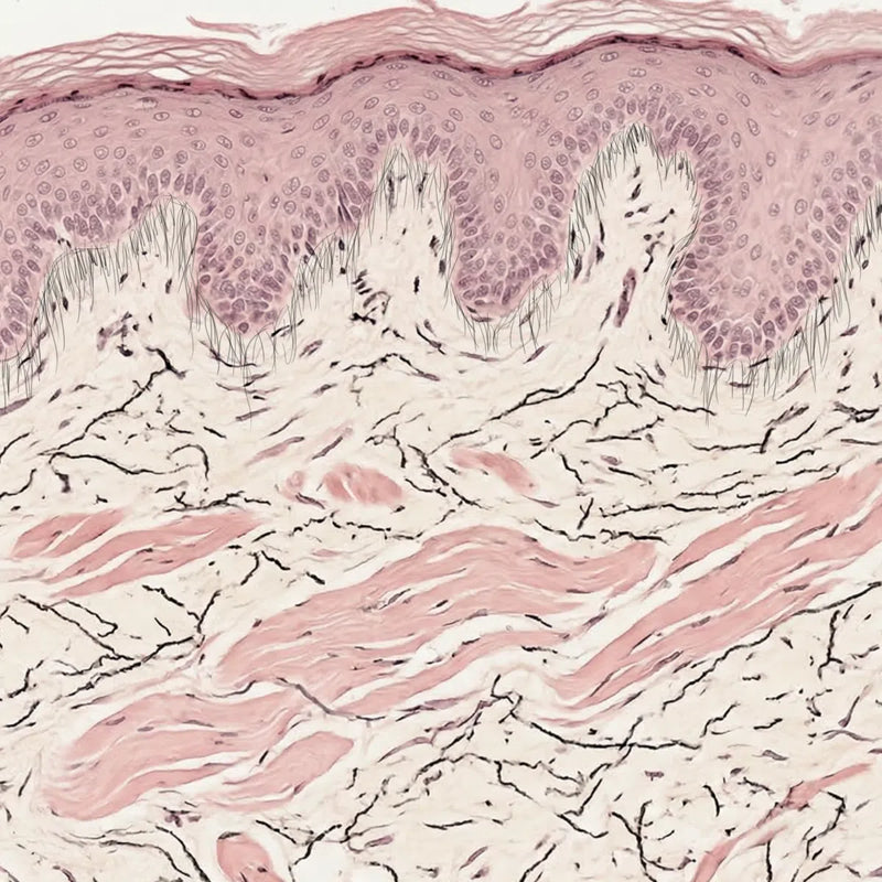 Verhoeff-Van Gieson staining showing organised elastic fibres in healthy skin